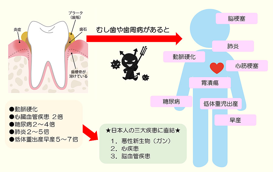 全身疾患への影響図